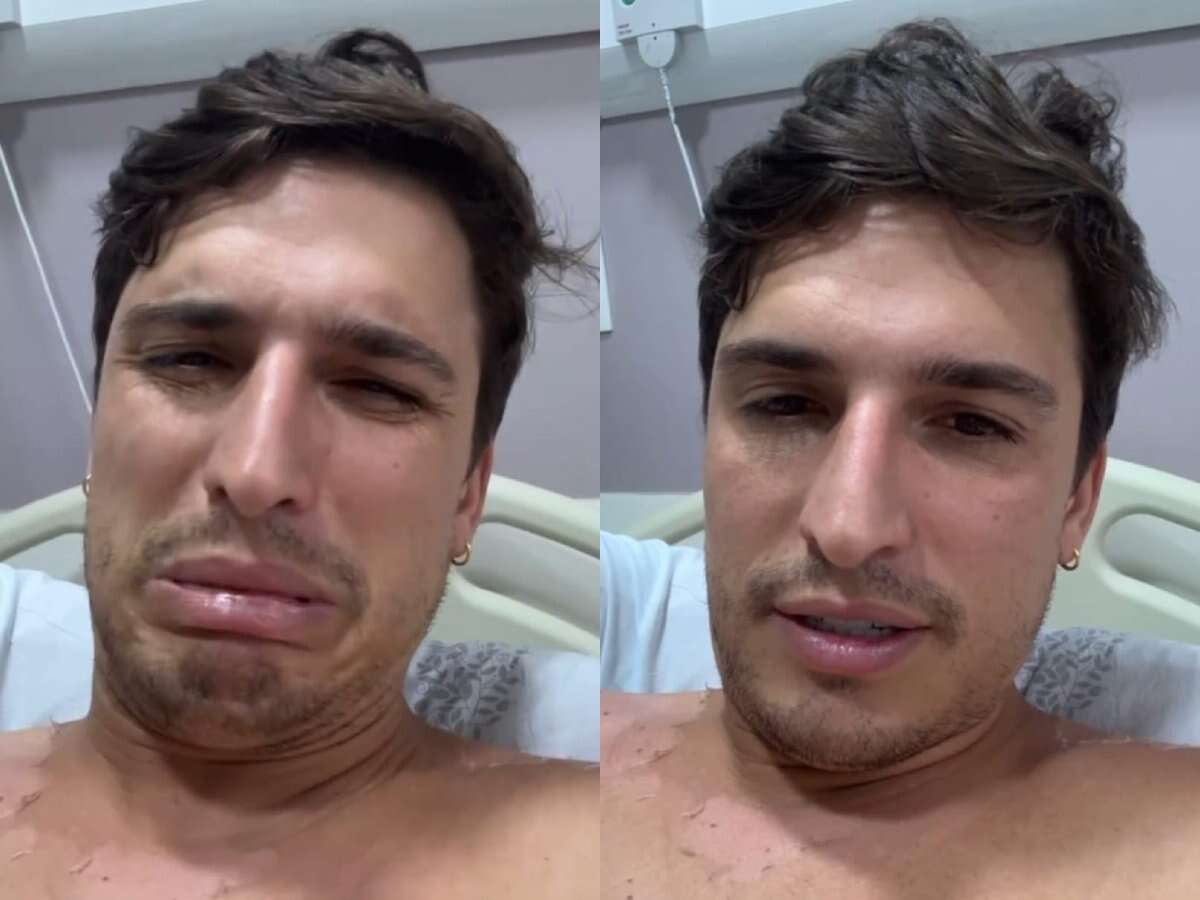 Ex-BBB Felipe Prior é internado com infecção e surge com olho estourado