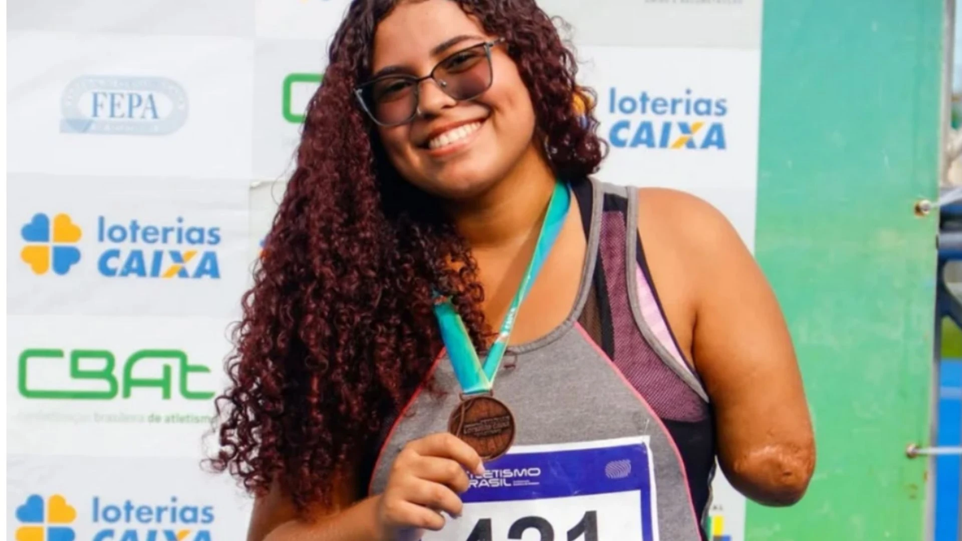 Justiça nega indenização a jovem que perdeu braço em ataque de tubarão em praia do Nordeste e diz que vítima 'assumiu risco'