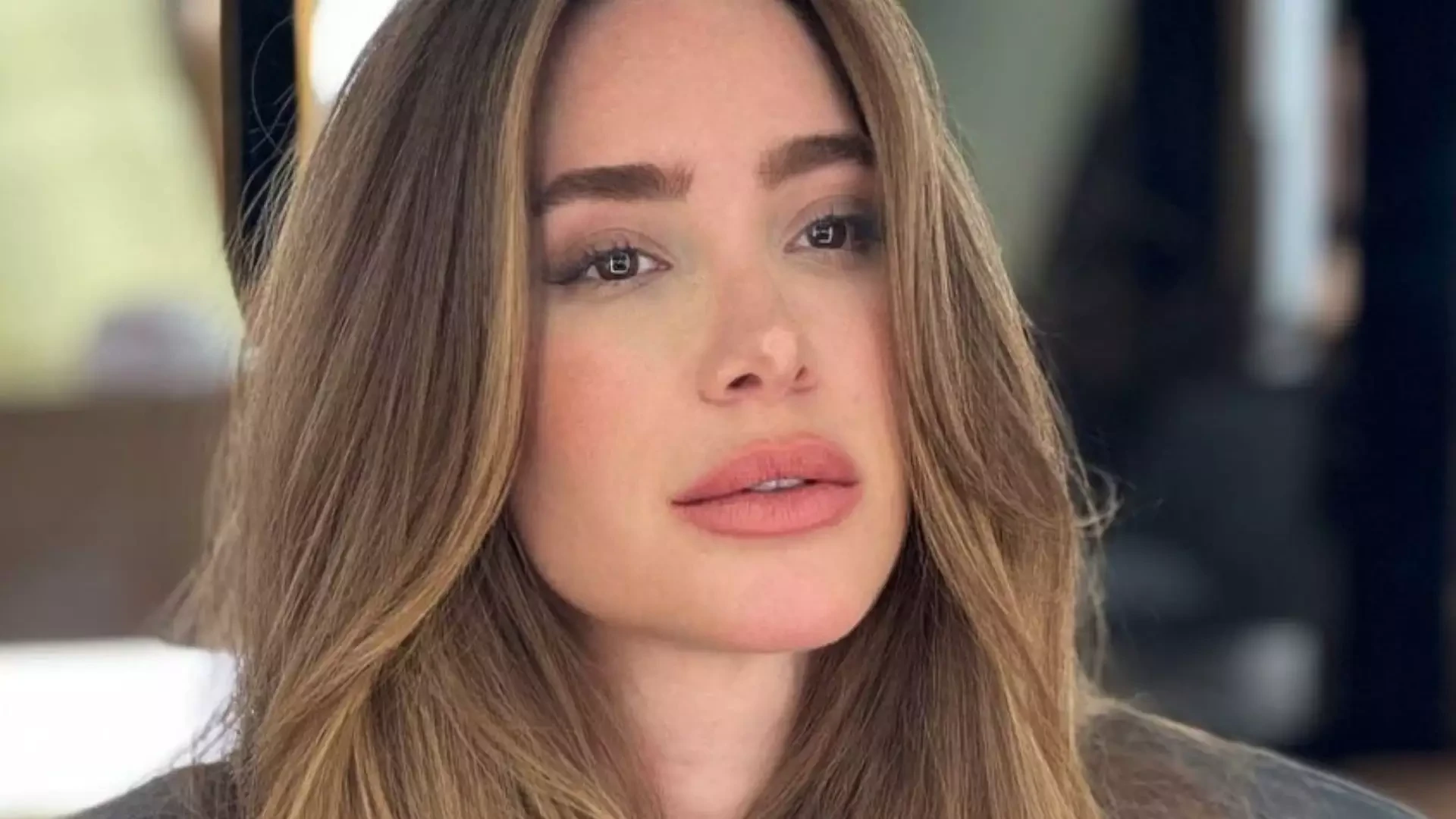 Romana Novais mostra seios com ondulações após complicação com silicone e desabafa