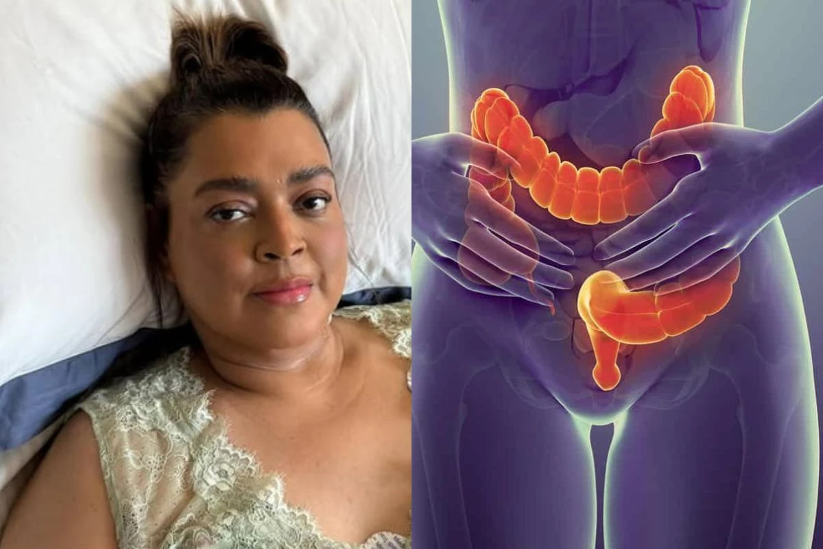 Câncer que matou Preta Gil: como prevenir, reconhecer os sintomas e quando procurar um médico