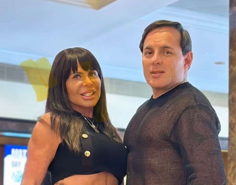 Marido de Gretchen surpreende ao comparar visual antes e depois das plásticas