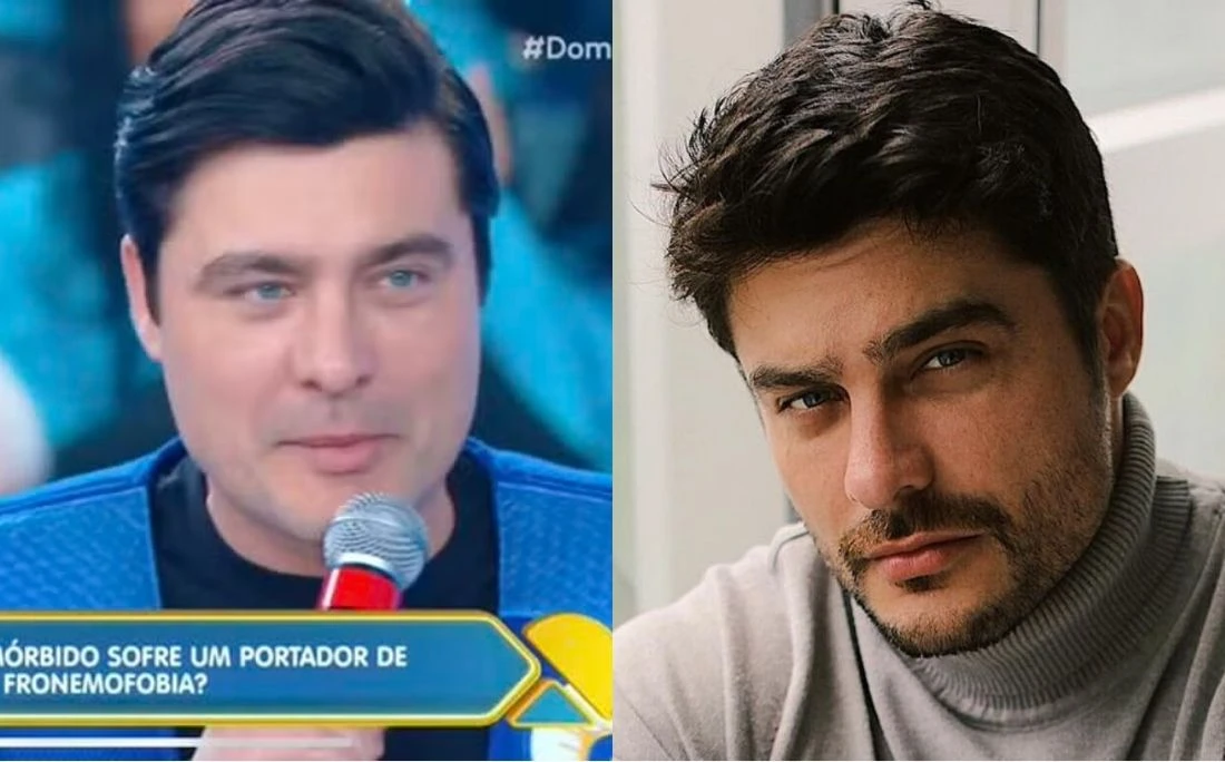 Guilherme Leicam rebate críticas à harmonização: ‘Só falam do meu rosto’