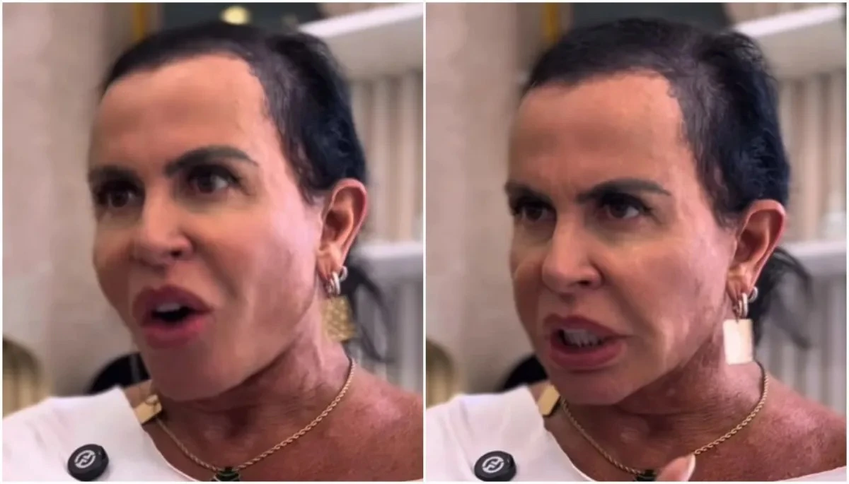 Gretchen surpreende ao surgir com novo visual após alopecia: 'Me sinto poderosa'