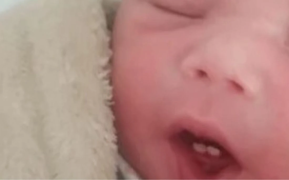 Bebê nasce com dois dentes e surpreende família: 'Fiquei perplexo'
