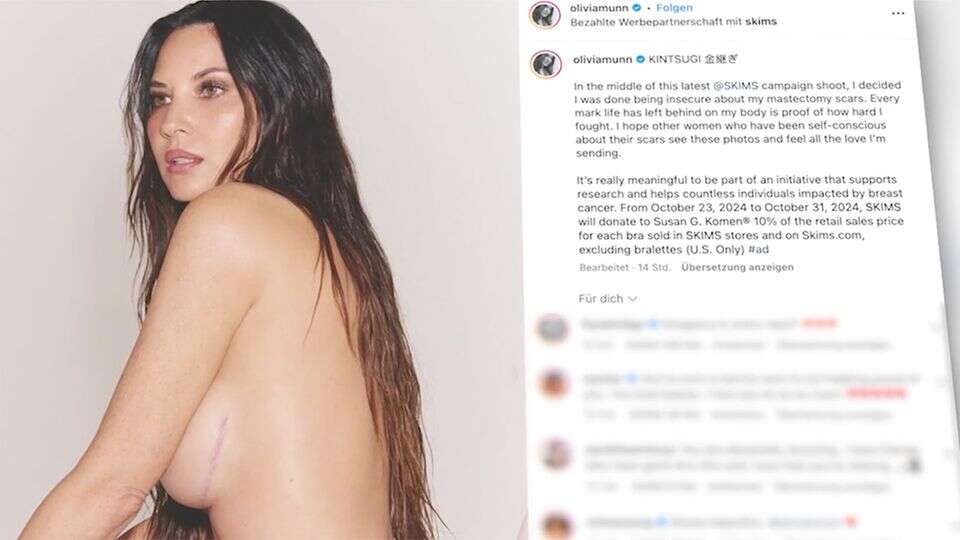 Fotoshooting für Kardashian Hollywood-Star Olivia Munn zeigt Narben nach Brustkrebs-OP