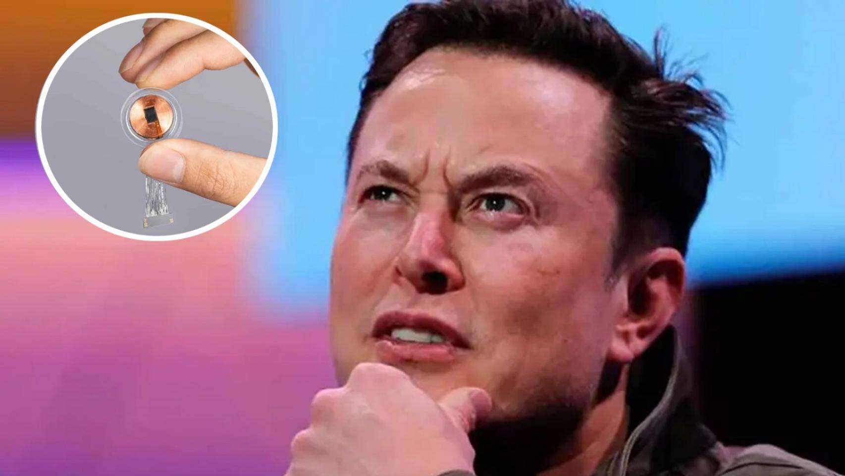 Los neurólogos desmontan el chip cerebral de Elon Musk: 