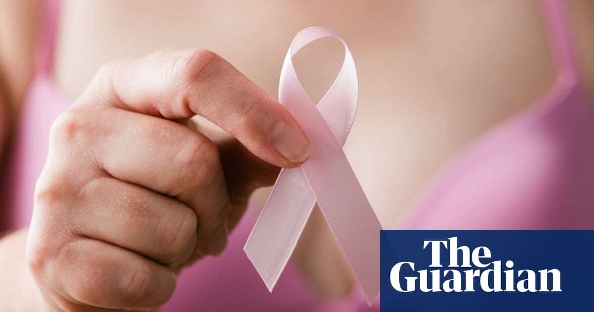 US breast cancer deaths fall but younger women increasingly diagnosed – study