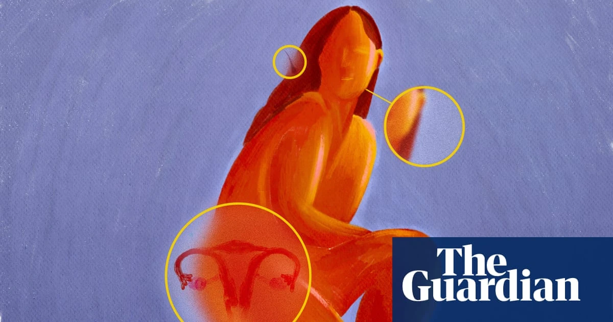 Can a name change transform PCOS outcomes for women? – podcast