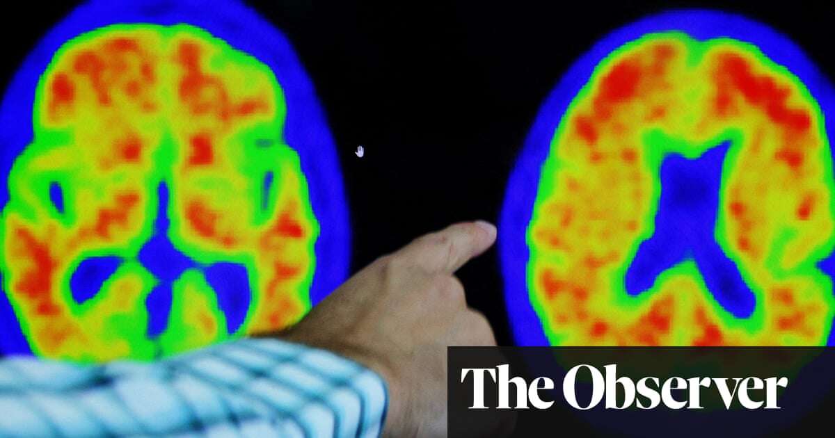 New Alzheimer’s drugs bring hope of slowing disease for UK patients