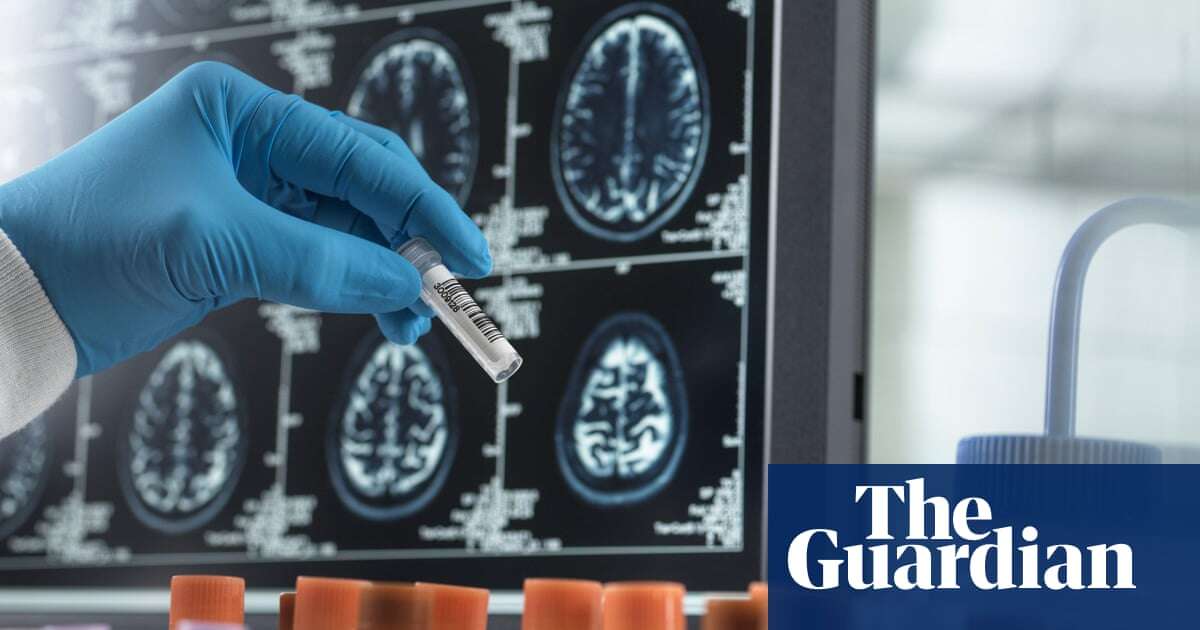 Tens of thousands of UK dementia patients to be enrolled in clinical trials