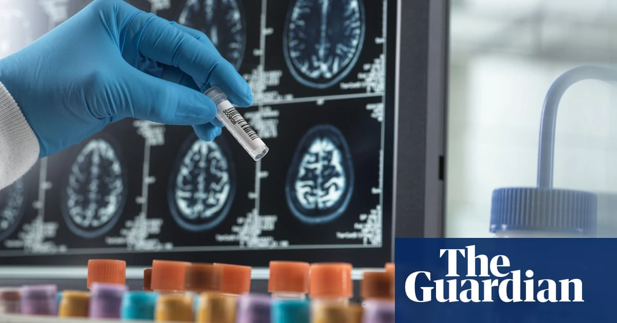 Thousands to be offered blood tests for dementia in UK trial