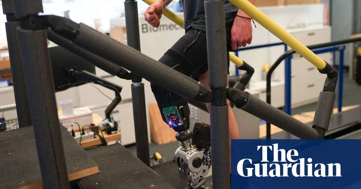 Bionic leg makes walking quicker and easier for amputees, trial shows