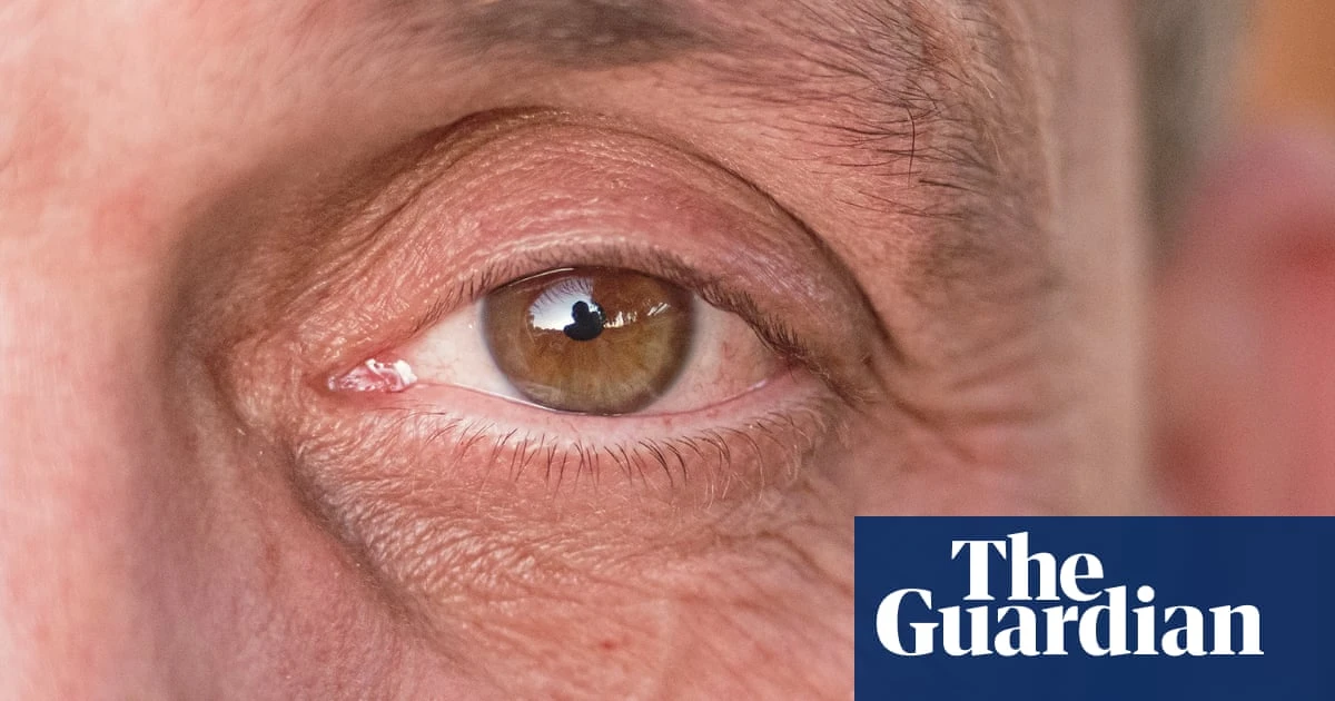 Blinking fools? The men who think shaving off their eyelashes will make them more masculine