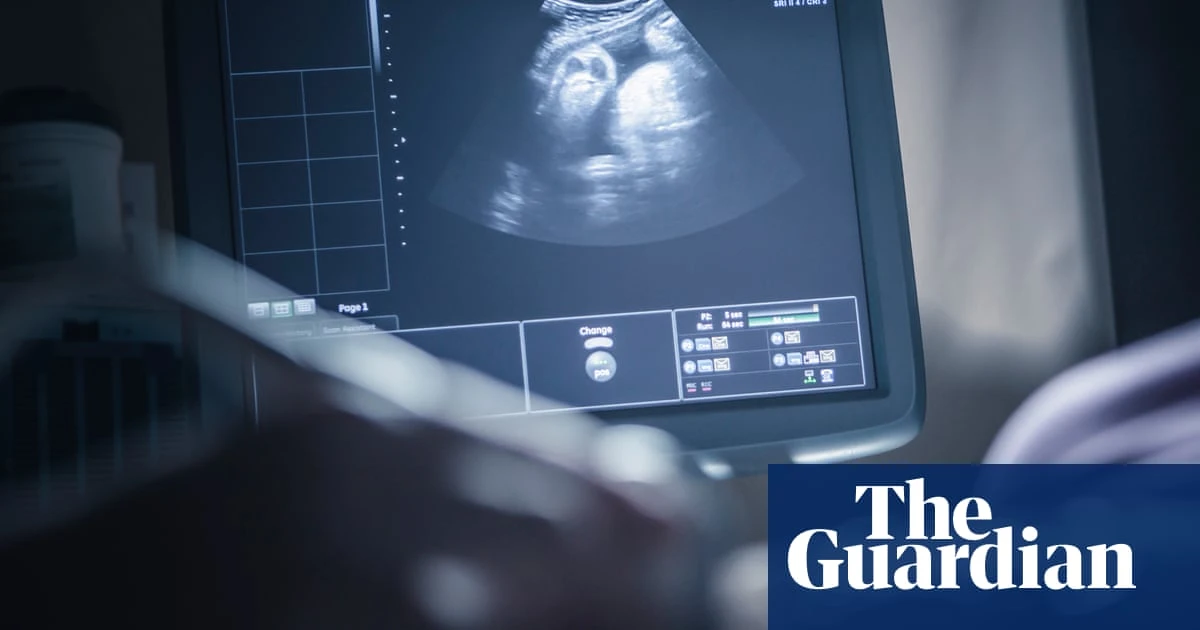 Test developed to identify women at increased risk of miscarriage