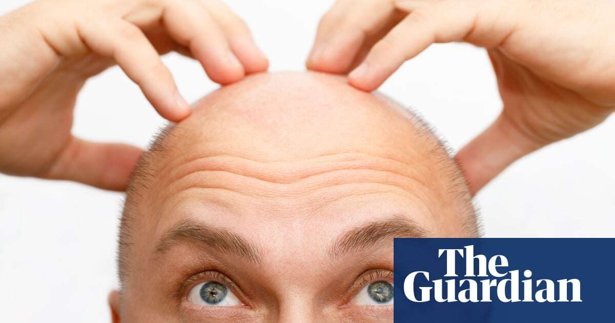 Why do we lose our hair as we age, and what can we do about it? – podcast