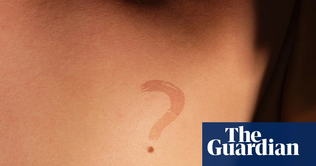 Sali Hughes on beauty: I make no apologies for repeating myself – keeping track of your moles is vital