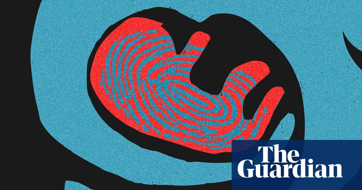 How the anti-abortion movement embraced fringe ‘abolitionists’ and became more punitive