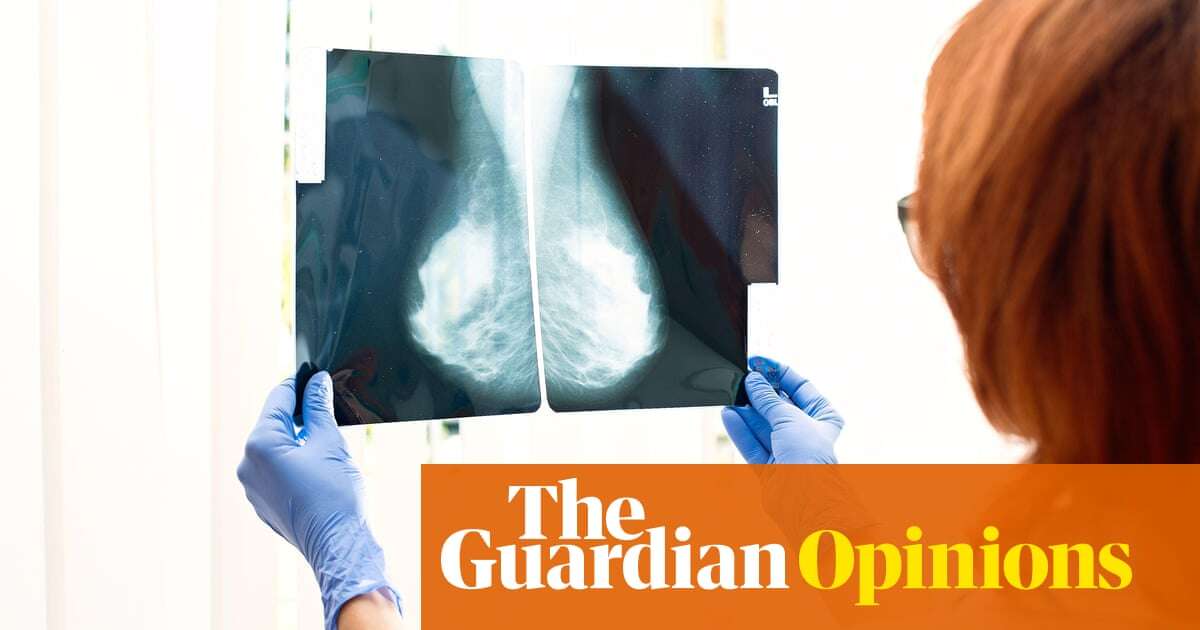 Medical research Why did my mammogram not detect my stage three breast cancer?