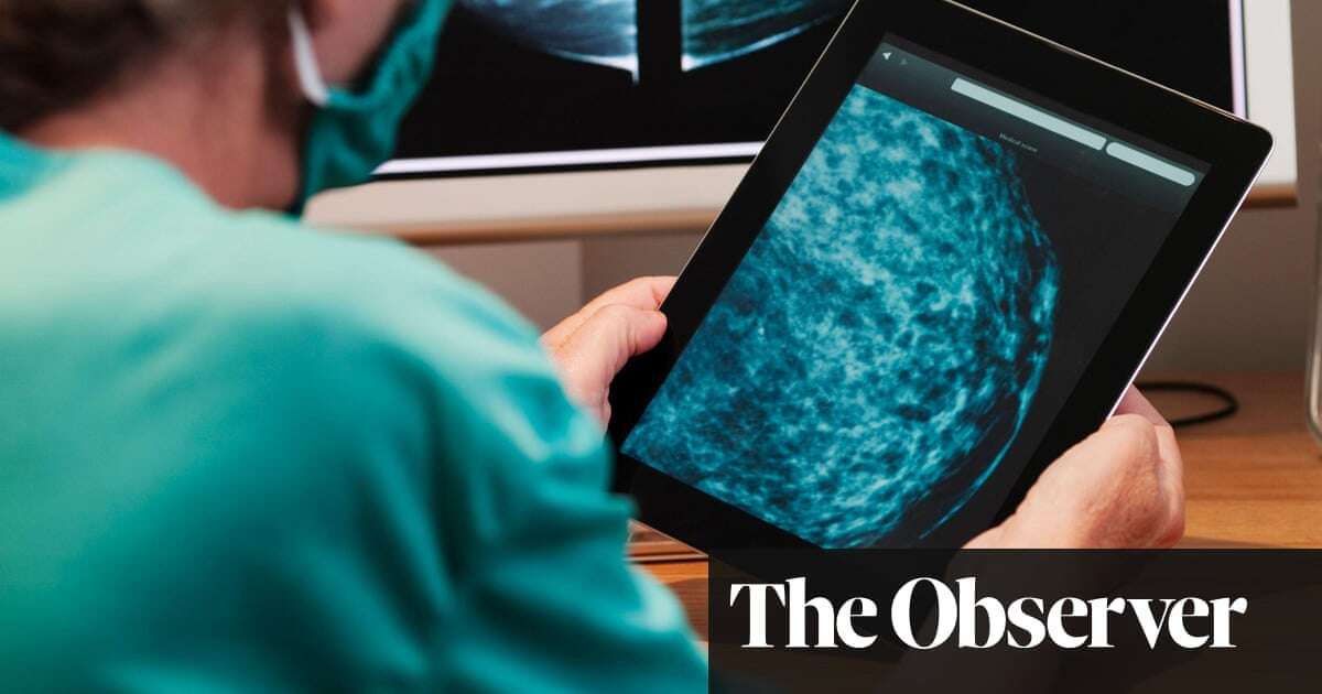 Predictive blood test hailed as ‘incredibly exciting’ breast cancer breakthrough