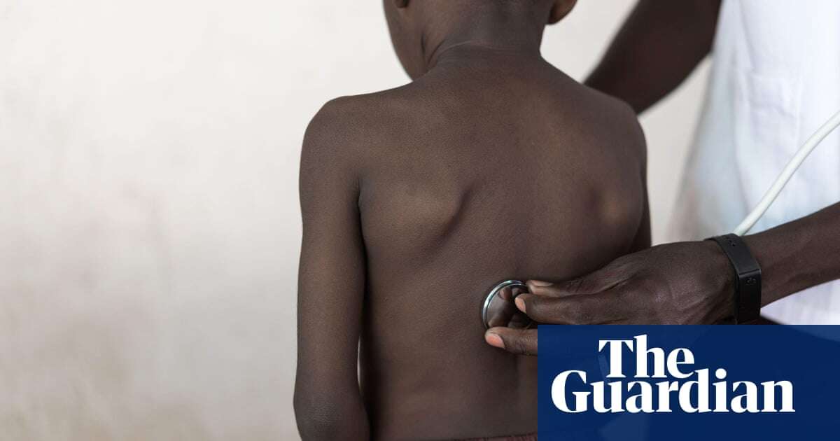 Millions of teenagers in Africa have undiagnosed asthma – study