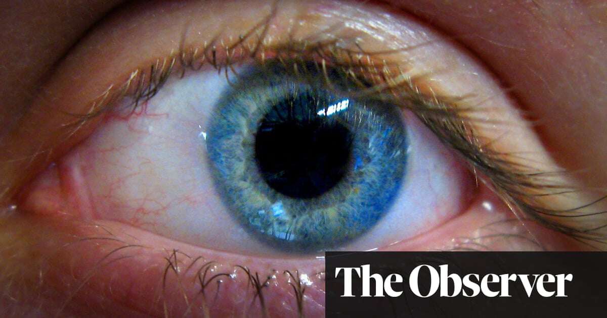 High street opticians could use AI to spot dementia risk with eye scan