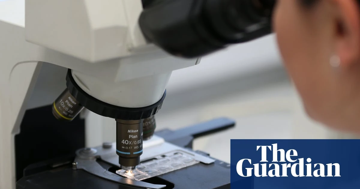 New AI test can predict which men will benefit from prostate cancer drug