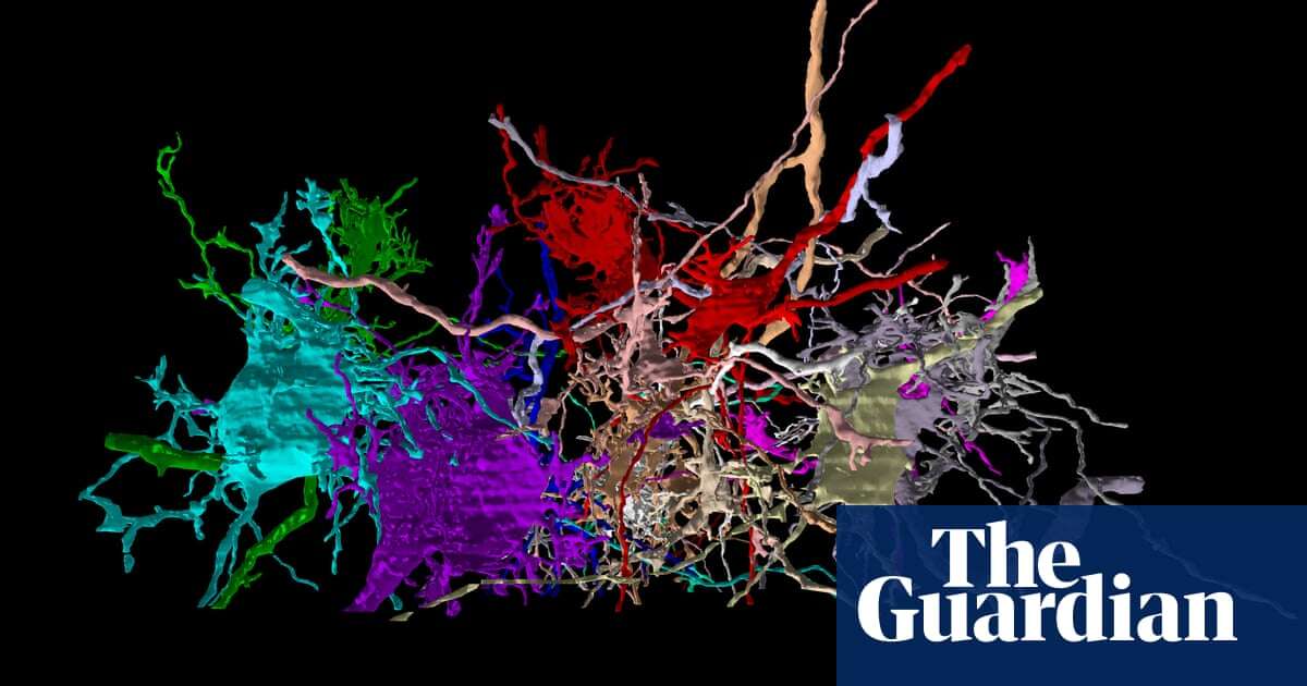 AI brain map could help demystify Alzheimer’s and autism