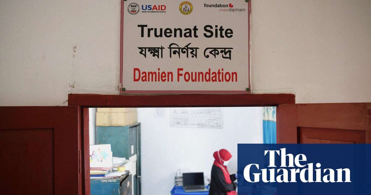 US aid cuts could create untreatable TB bug ‘resistant to everything we have’