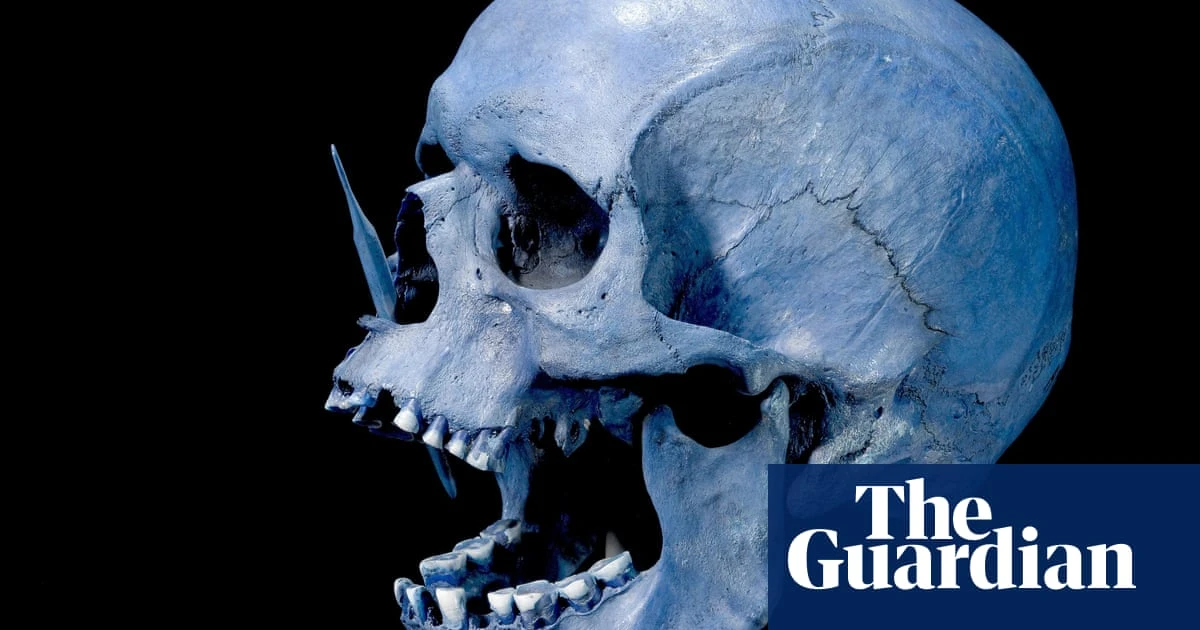 Ancient steppe herders brought higher risk of MS to northern Europe