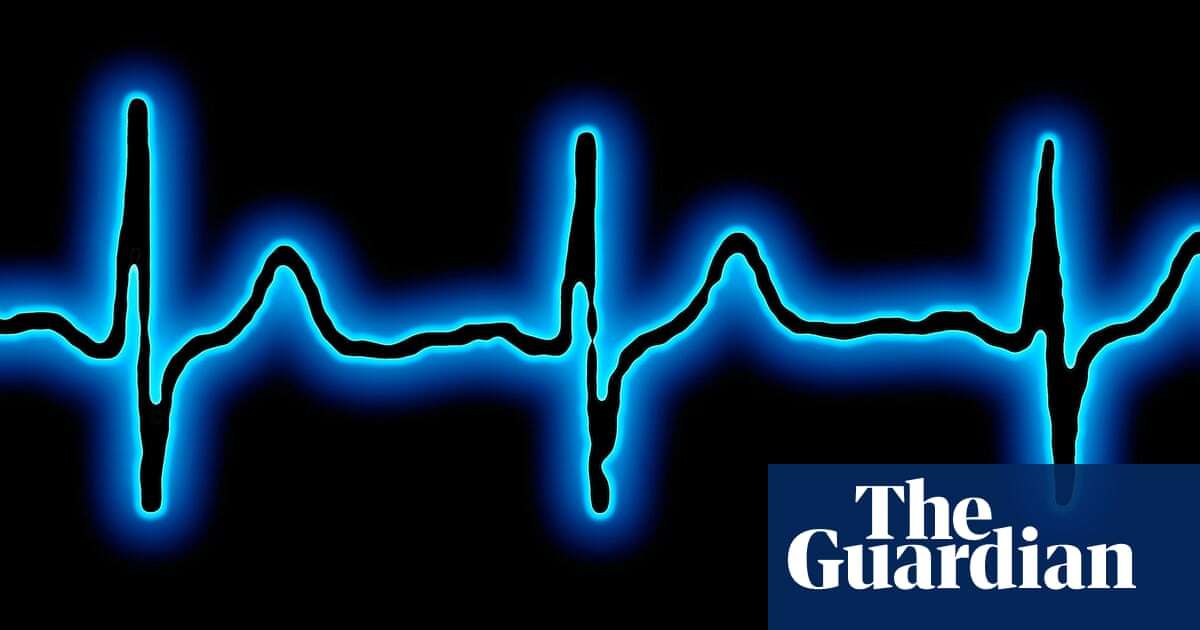 Outdated guidelines mean doctors failing to spot heart condition in women