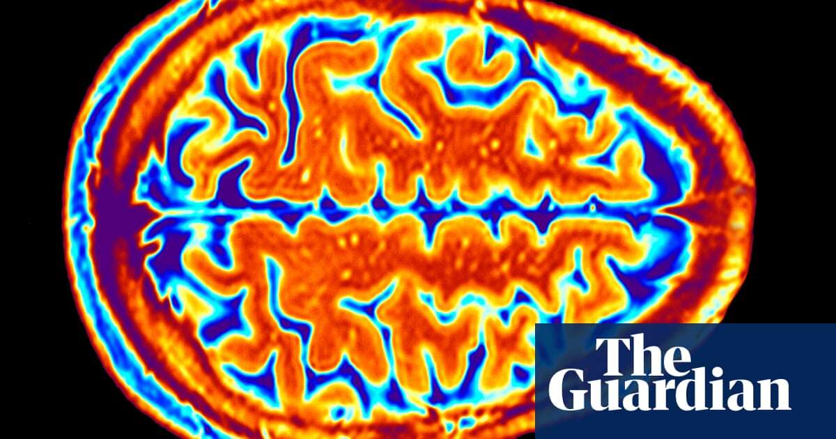 There’s little evidence of a ‘brain microbiome’ | Letter