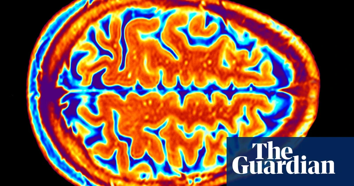 Medical research How AI is making non-invasive mind reading a reality – podcast