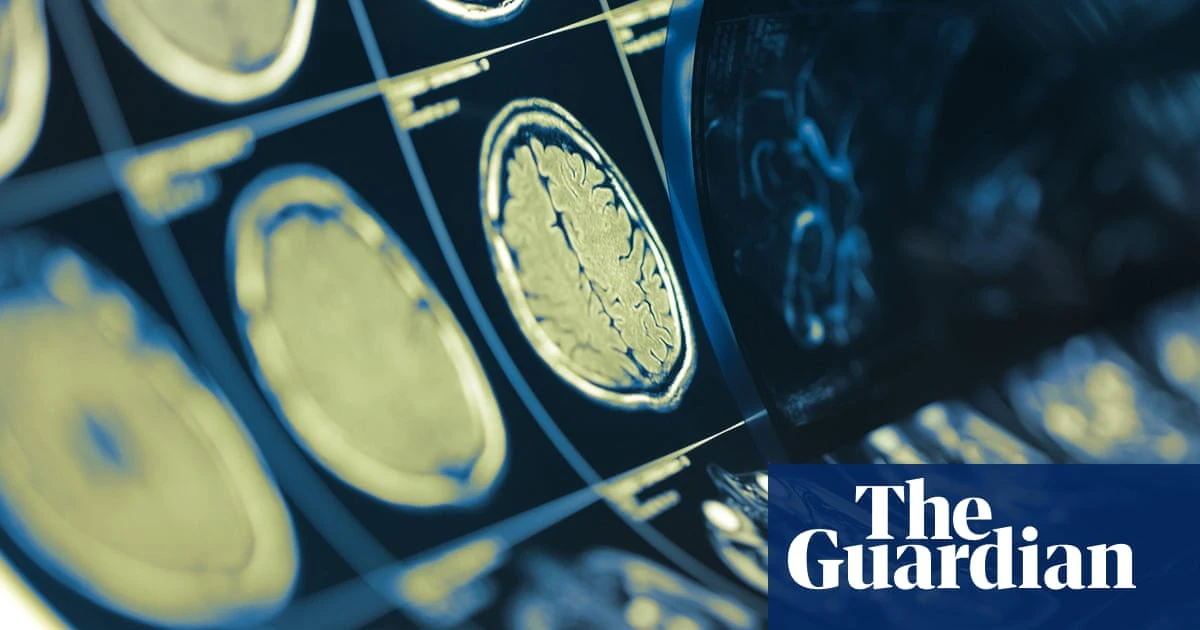 ‘Gift of life’: experts hail neck and head cancer breakthrough