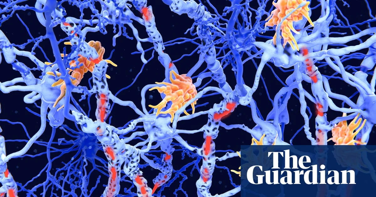 ‘Inverse vaccines’: the promise of a ‘holy grail’ treatment for autoimmune diseases