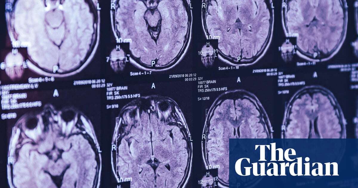 Top Canadian scientist alleges in leaked emails he was barred from studying mystery brain illness