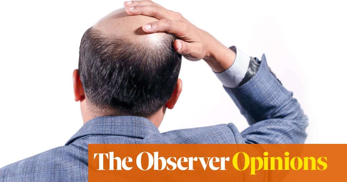 Is baldness a thing of the past? Or will it grow on us again? | Eva Wiseman