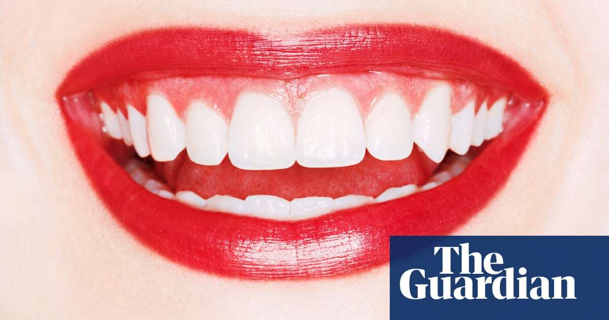 When veneers go very wrong: ‘I knew I’d made the biggest mistake of my life’