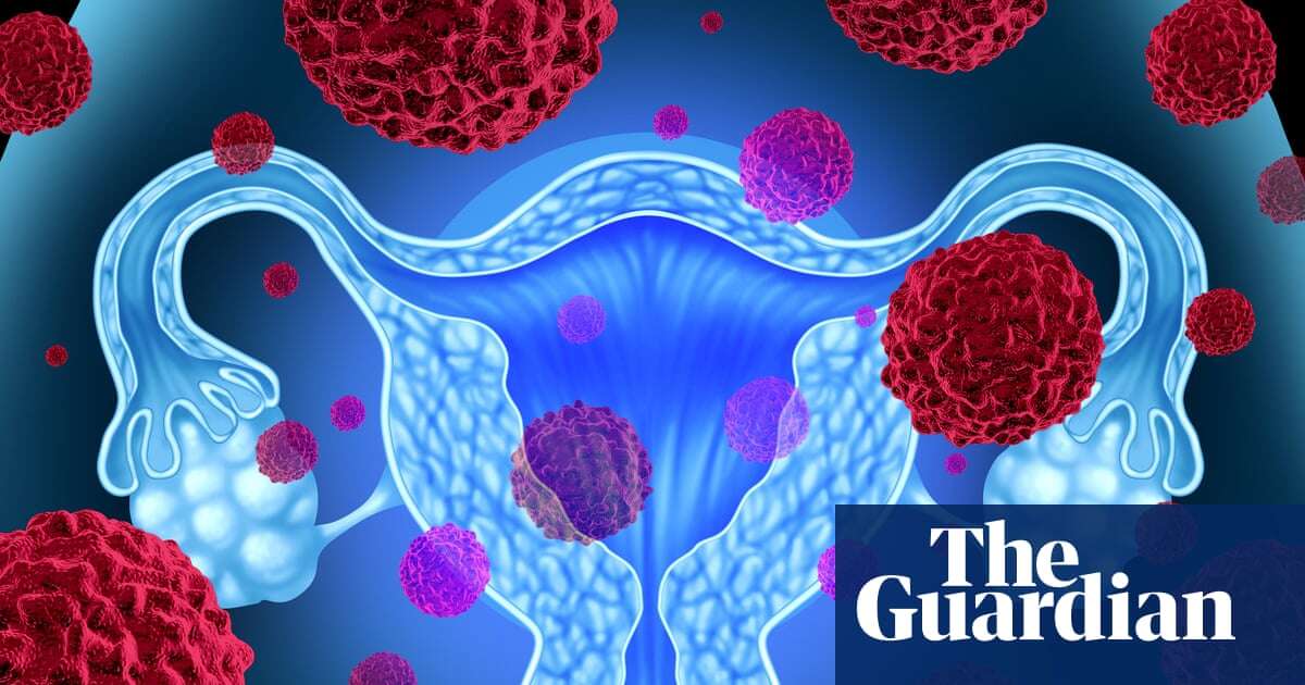 Drug that could slow womb cancer to be rolled out by NHS in England