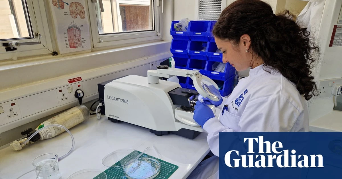 Living human brain tissue used to mimic Alzheimer’s in breakthrough study