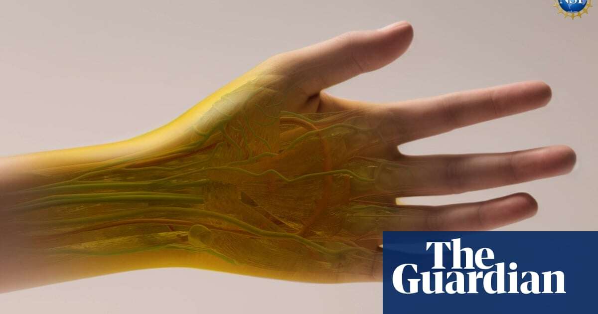 Transparent skin, bird flu, and why girls’ brains aged during Covid: the week in science – podcast