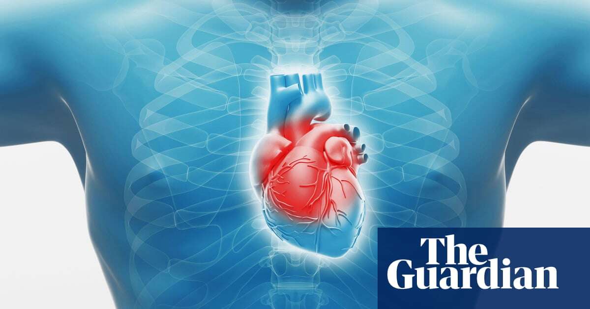 ‘Groundbreaking’: scientists develop patch that can repair damaged hearts