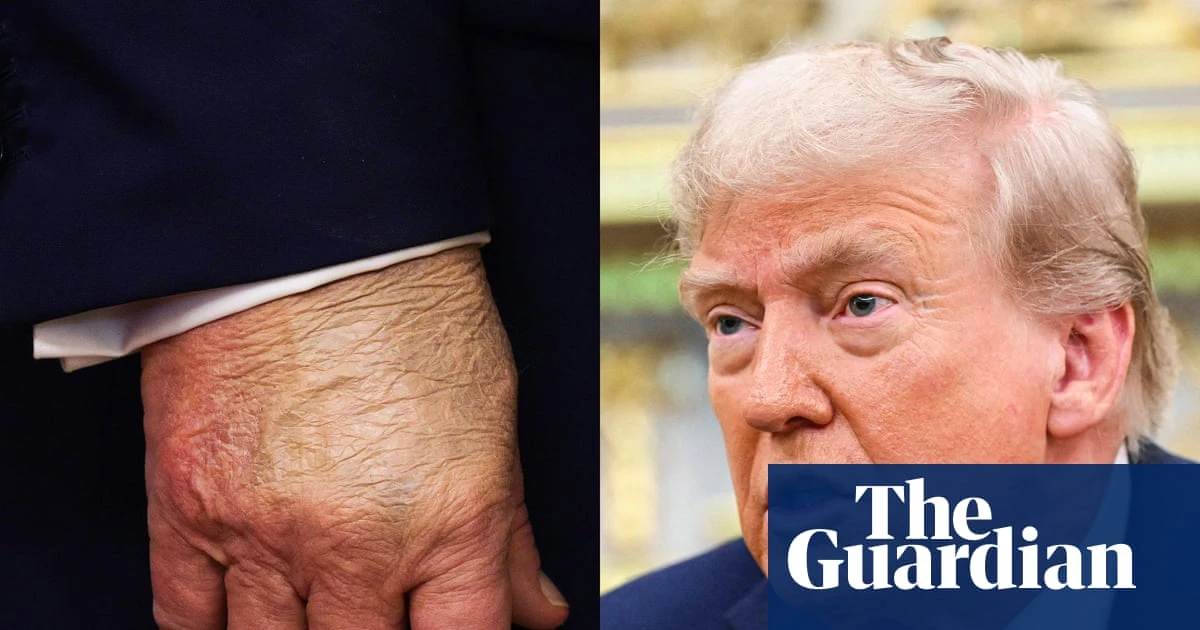 What the ‘is Trump dead?’ rumours reveal about our current moment