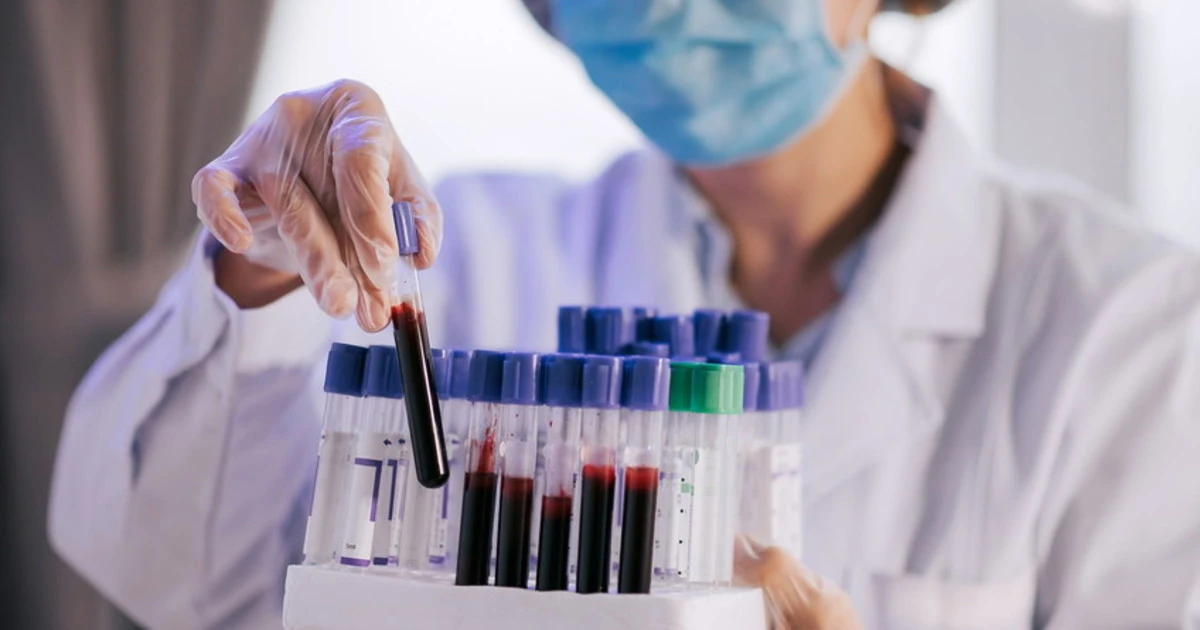 L'organo che invecchia prima e il rischio-morte: sangue, il test che cambia la storia