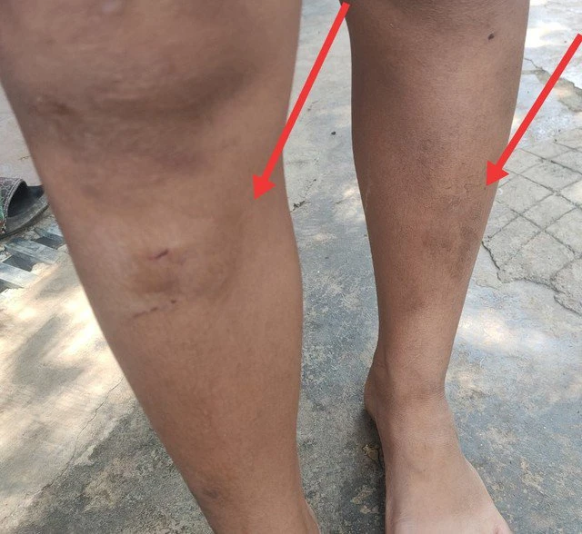 Vụ 5 cháu nhỏ bị hàng xóm đánh bầm dập: Chuyển hồ sơ lên Công an TP Buôn Ma Thuột