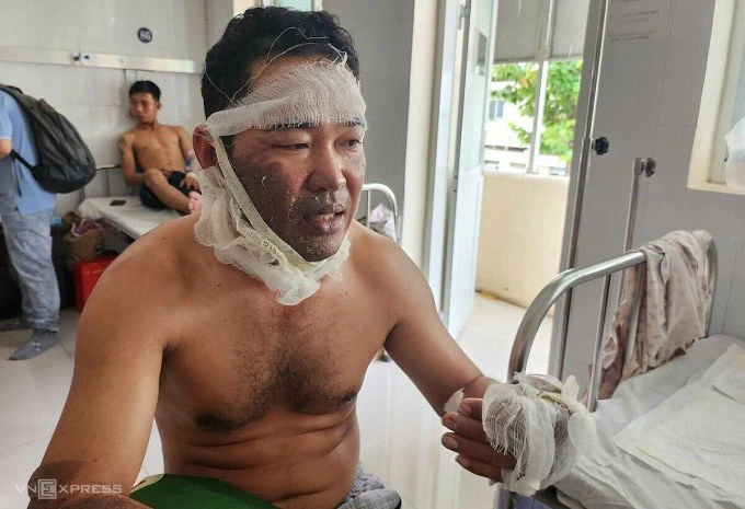Công nhân vụ nổ nhà máy gỗ: 'Lửa như quả cầu phụt xa hàng chục mét'
