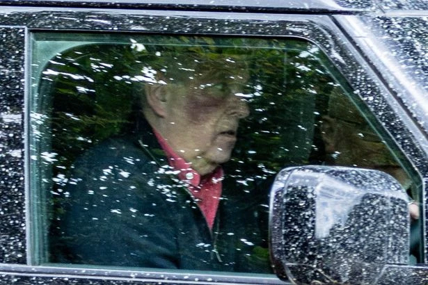 Disgraced Andrew Windsor spotted with huge mystery bruise on face as he drives near home