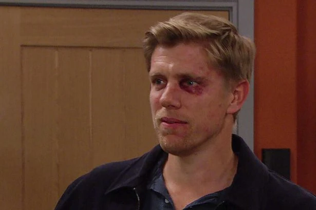 Emmerdale fans 'rumble' Robert Sugden's real mum and she's in Dales already