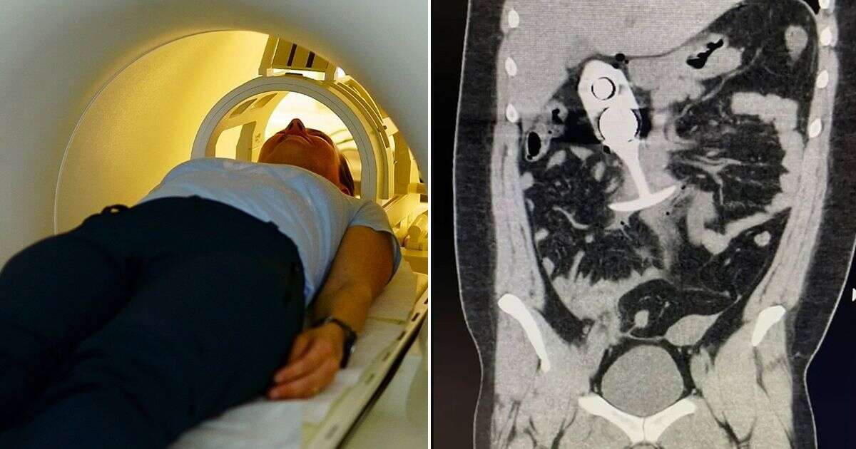 Woman suffers horrifying injuries as sex toy 'dragged through body' in MRI scan