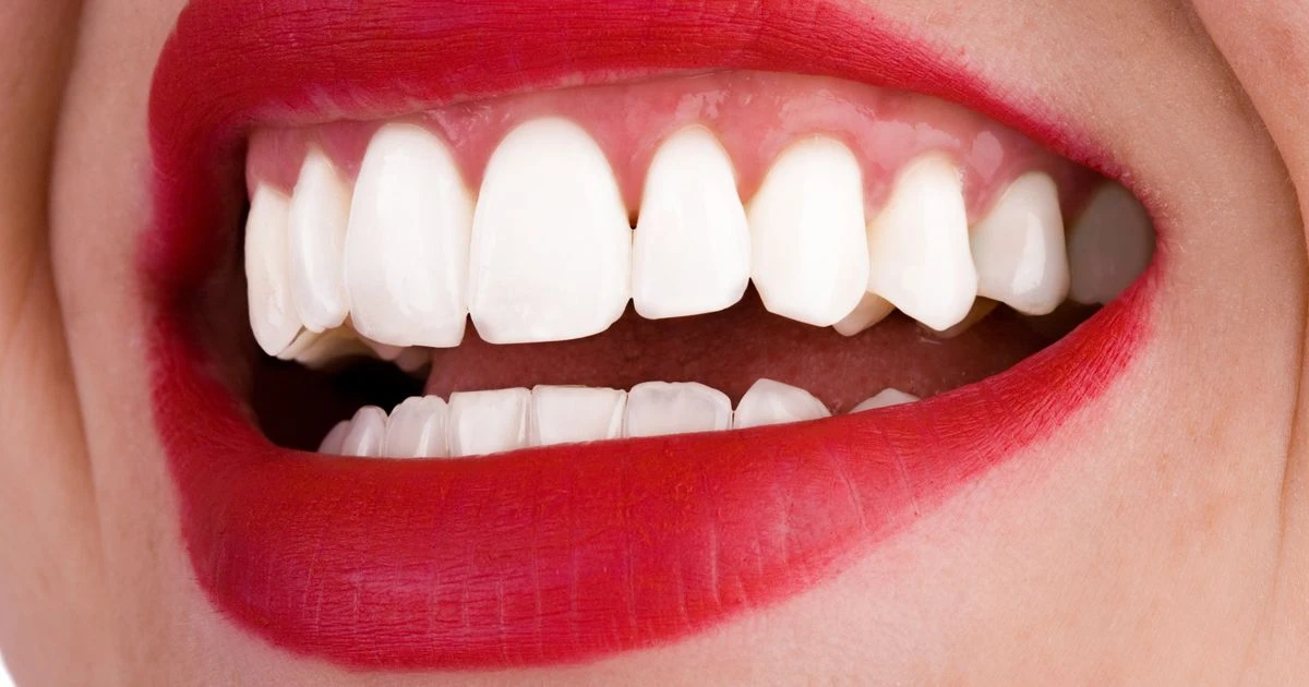 Best teeth whitening gels for 2021 that will help you get a bright white smile