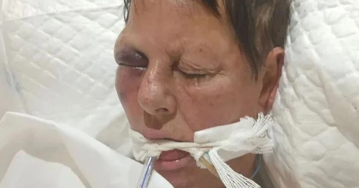 Brit tourist fighting for life in Ibiza hospital after 'heat stroke collapse'